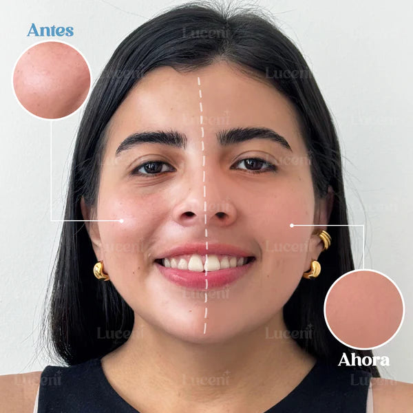 Candy Bella® – Gel Prensado Matificante para una piel fresca y sin brillo al instante